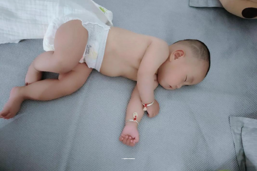 株洲六个月宝宝眼睛散光